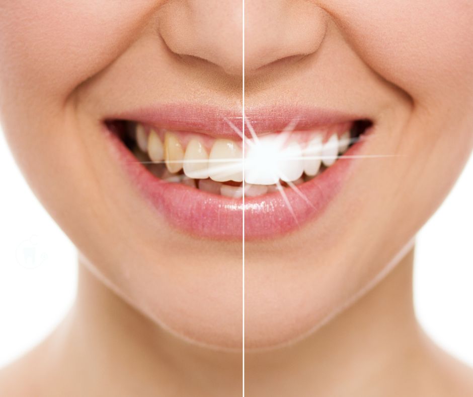 Original Dazzling Whiting Oral Pen, Instant Teeth Whitening Pen